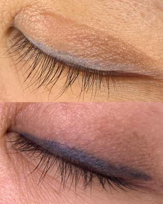 Pico Tauro Laser